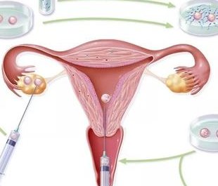 确诊为免疫性不孕能在天门市做试管婴儿吗？做三代试管需要多少钱？